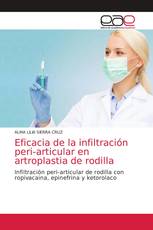 Eficacia de la infiltración peri-articular en artroplastia de rodilla