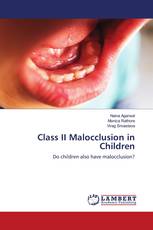 Class II Malocclusion in Children