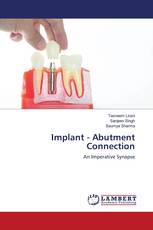 Implant - Abutment Connection