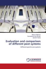 Evaluation and comparison of different post systems