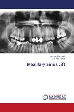 Maxillary Sinus Lift