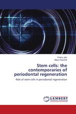 Stem cells: the contemporaries of periodontal regeneration