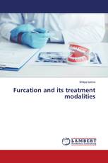 Furcation and its treatment modalities