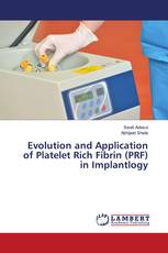 Evolution and Application of Platelet Rich Fibrin (PRF) in Implantlogy