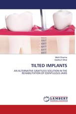 Tilted Implants