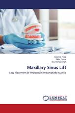 Maxillary Sinus Lift
