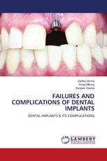 FAILURES AND COMPLICATIONS OF DENTAL IMPLANTS