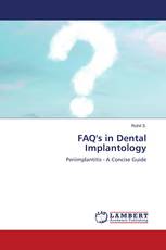 FAQ's in Dental Implantology