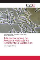 Adenocarcinoma de Próstata Metastásico Resistente a Castración