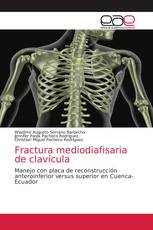 Fractura mediodiafisaria de clavícula