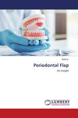 Periodontal Flap