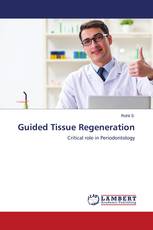 Guided Tissue Regeneration