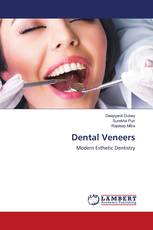 Dental Veneers