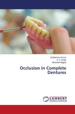 Occlusion in Complete Dentures