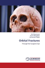 Orbital Fractures