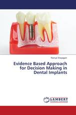 Evidence Based Approach for Decision Making in Dental Implants