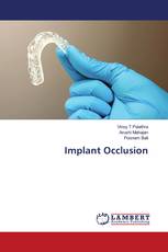 Implant Occlusion