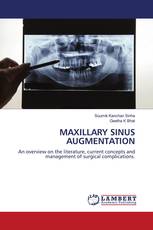 MAXILLARY SINUS AUGMENTATION