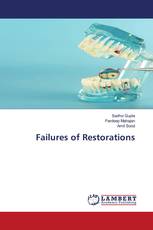Failures of Restorations
