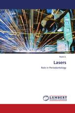 Lasers