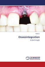 Osseointegration
