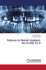 Failures In Dental Implant- An In-Site To It