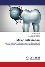 Molar distalization