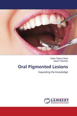 Oral Pigmented Lesions