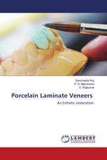 Porcelain Laminate Veneers