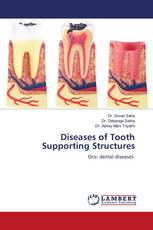 Diseases of Tooth Supporting Structures