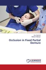 Occlusion in Fixed Partial Denture