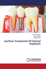 Surface Treatment Of Dental Implants