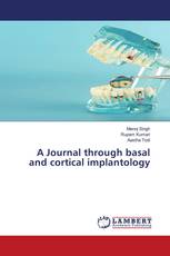 A Journal through basal and cortical implantology