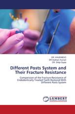 Different Posts System and Their Fracture Resistance