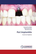 Peri Implantitis