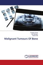 Malignant Tumours Of Bone