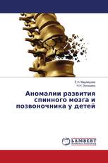 Аномалии развития спинного мозга и позвоночника у детей