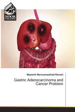 Gastric Adenocarcinoma and Cancer Problem