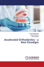 Accelerated Orthodontics - a New Paradigm