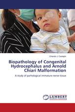 Biopathology of Congenital Hydrocephalus and Arnold Chiari Malformation