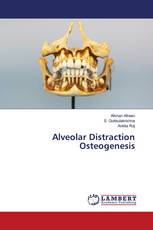 Alveolar Distraction Osteogenesis