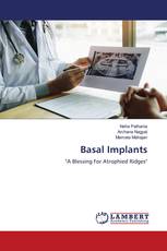 Basal Implants