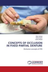 CONCEPTS OF OCCLUSION IN FIXED PARTIAL DENTURE