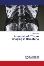Essentials of CT scan imaging in Hematuria
