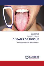 DISEASES OF TONGUE