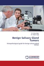 Benign Salivary Gland Tumors