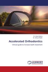 Accelerated Orthodontics