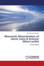 Rheumatic Mineralization of Aortic Valve & Anterior Mitral Leaflet