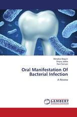 Oral Manifestation Of Bacterial Infection
