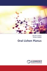 Oral Lichen Planus